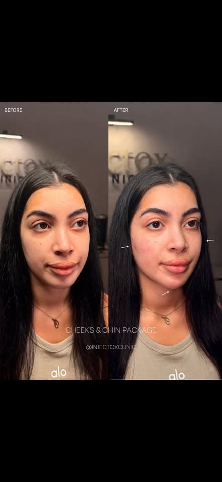 Facial Balancing