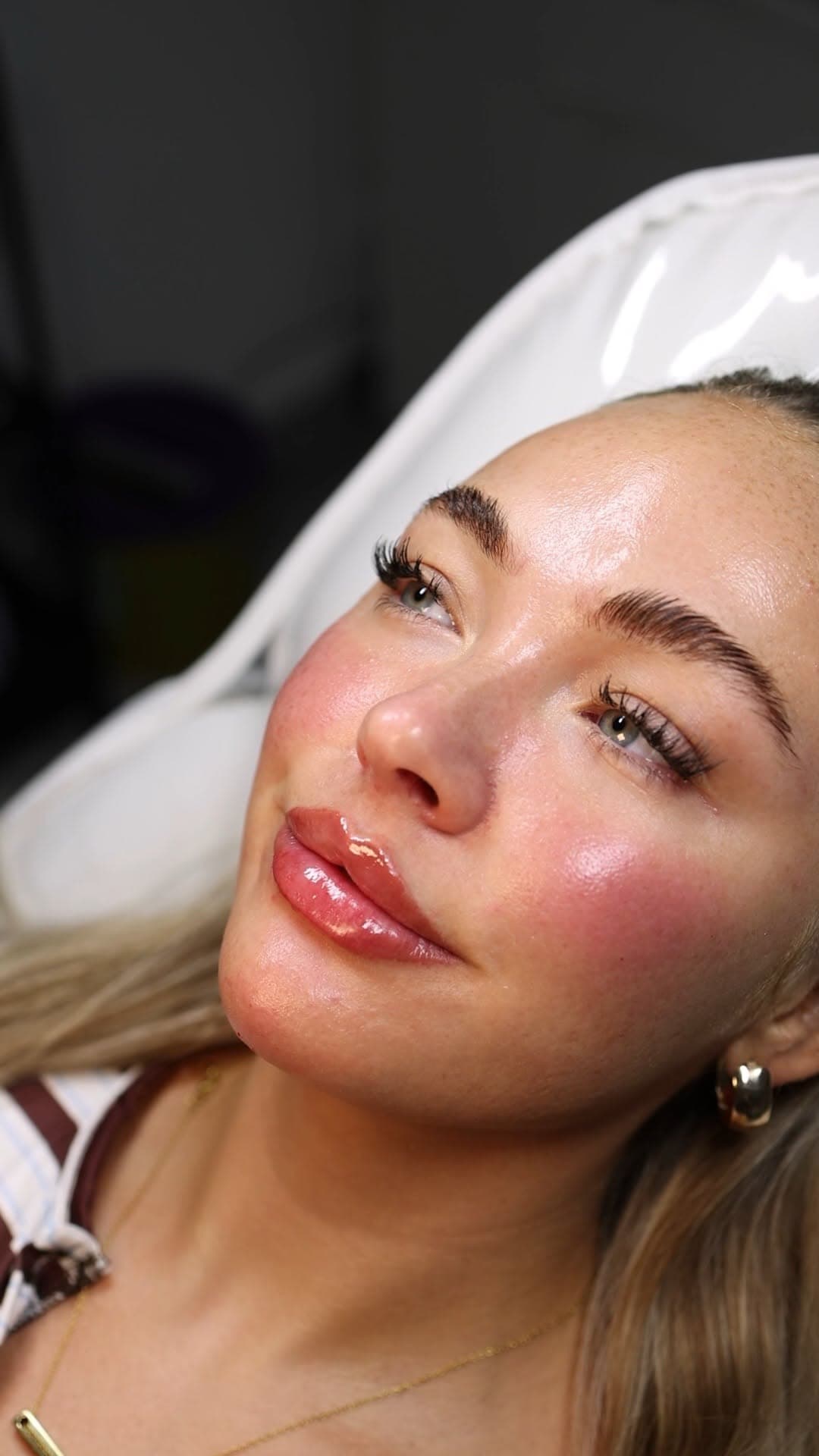 Russian Lip Filler